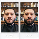 Hair Density Filler