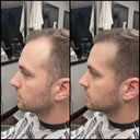 Hair Density Filler