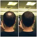 Hair Density Filler