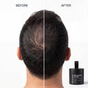 Hair Density Filler