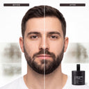 Hair Density Filler