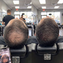Hair Density Filler