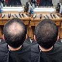 Hair Density Filler